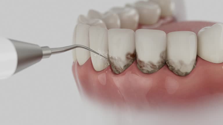 Reliable Teeth Cleaning And Checkup contractor in Vernon County County, MO by Dentist Open Now